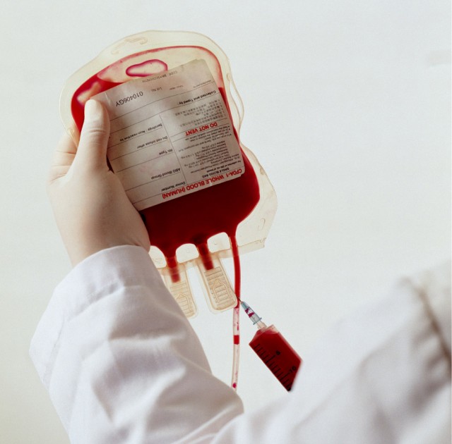 sange1 formă rară de leucemie