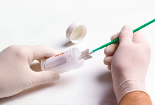 cervical-cancer-screening-smear-test-preparation-image3