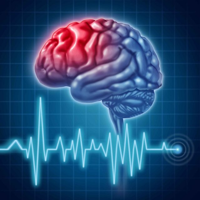 accident vascular cerebral
